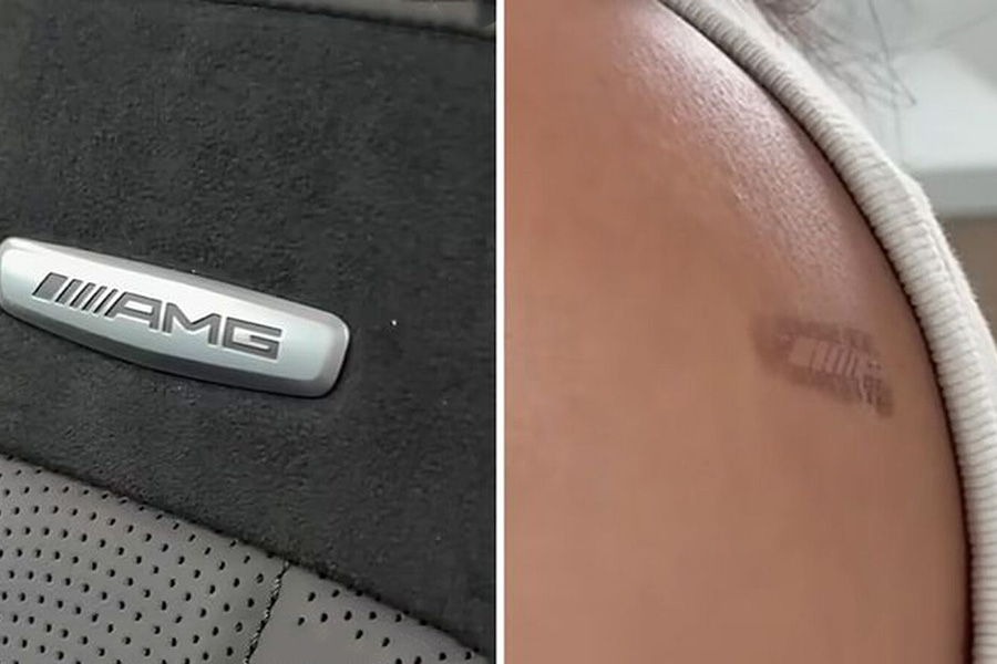 AMG jusque dans la peau: le logo qui brûle ses clients